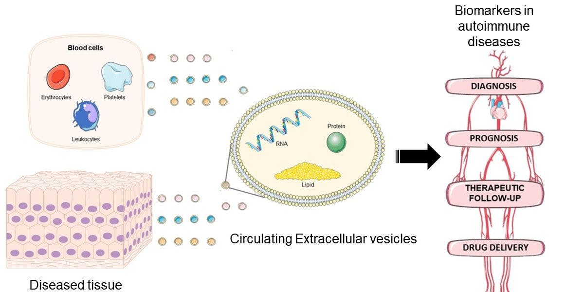 Circulating Extracellular vesicles in autoimmune diseases for early diagnosis