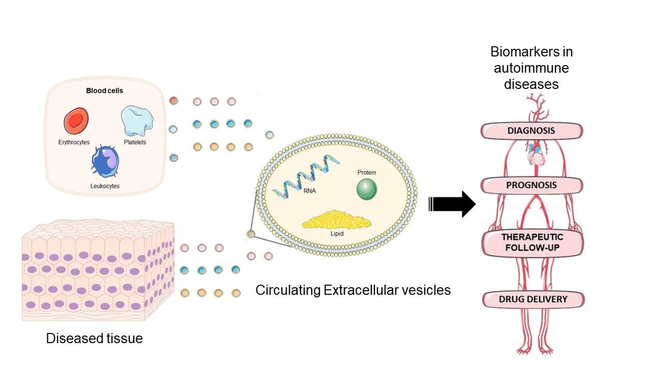 Circulating Extracellular vesicles in autoimmune diseases for early diagnosis